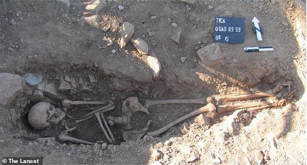 El esqueleto de 1.000 años de antigüedad fue descubierto en una tumba elíptica en Portugal.  El equipo extrajo ADN de los restos para revelar que el hombre tenía síndrome de Klinefelter.  Lo que sucede cuando hay un cromosoma X extra