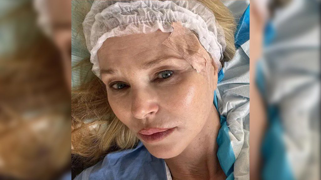 Christie Brinkley foto de la cirugía de cáncer de piel